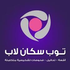 توب سكان